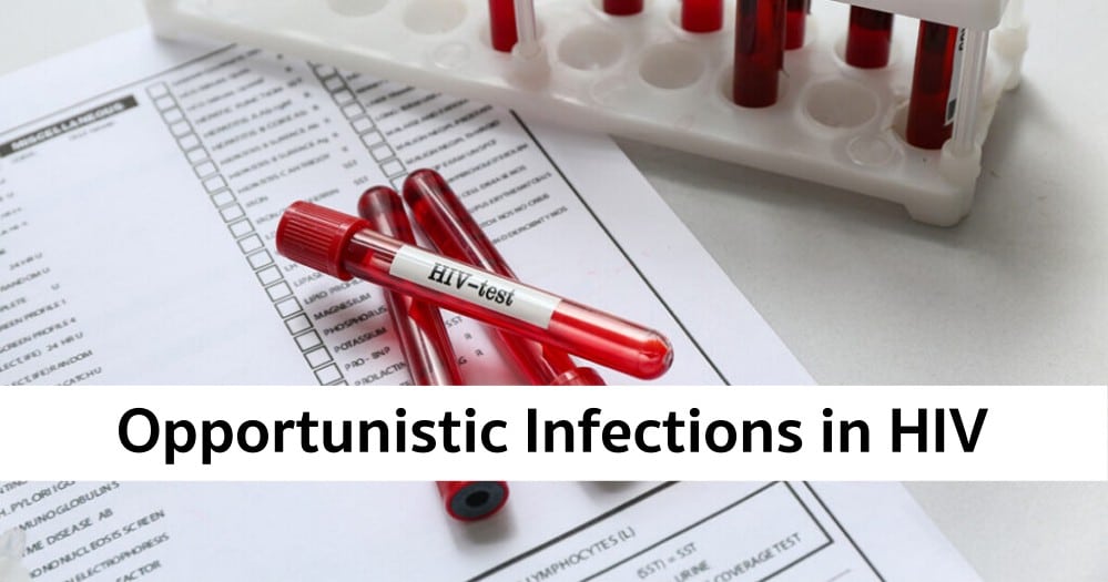 Opportunistic Infections in People with HIV: What They Are, Symptoms, and Treatment